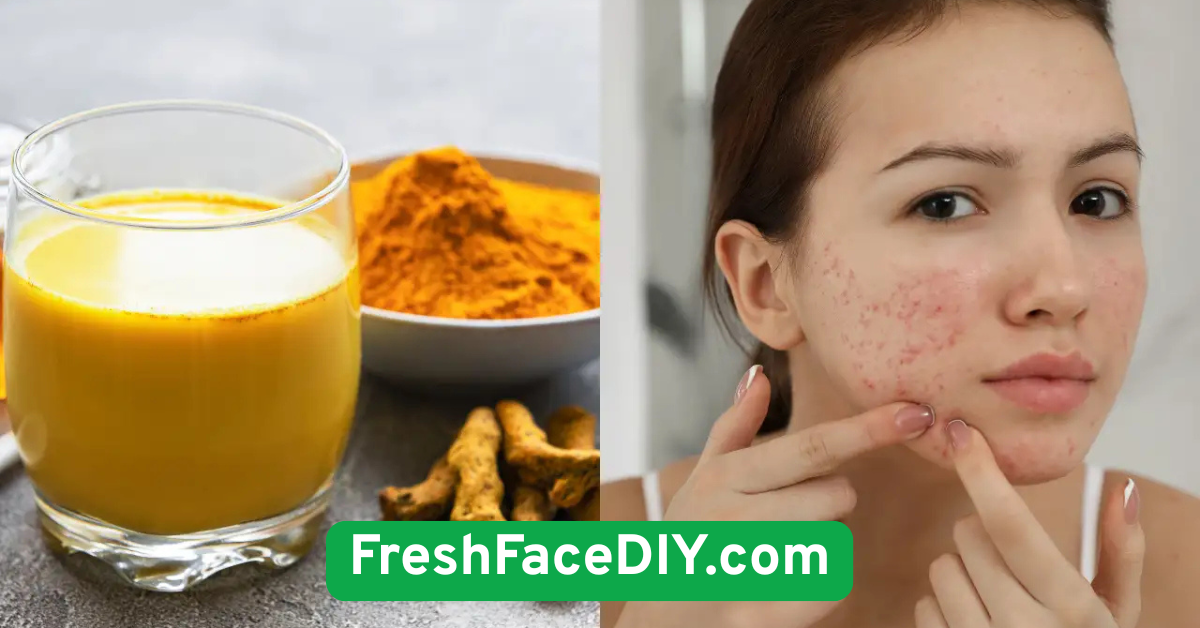 Turmeric & Honey Spot Treatment